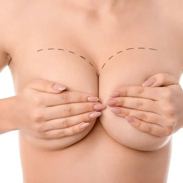 What-to-Expect-After-Breast-Reduction-Surgery