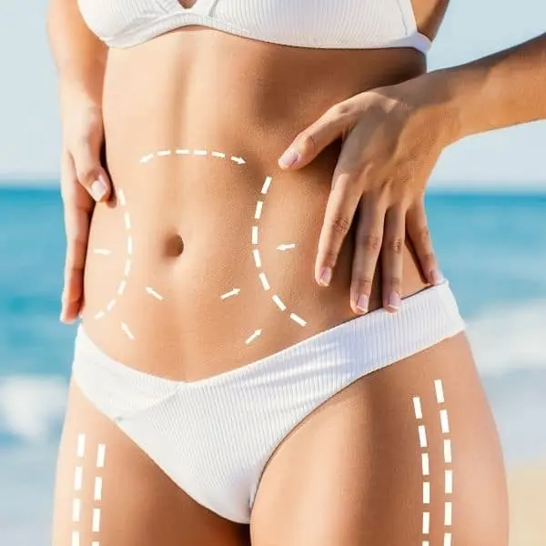Who-Can-Be-Treated-With-Liposuction